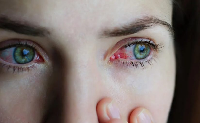 This woman’s eye infection was scarier: ‘I could see them moving around in my eye. ➤ Buzzday.info