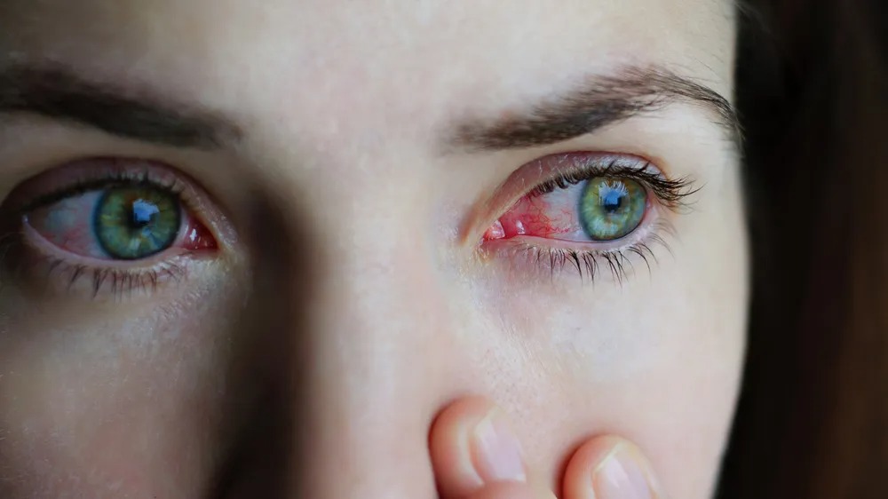 This woman’s eye infection was scarier: ‘I could see them moving around in my eye. ➤ Buzzday.info