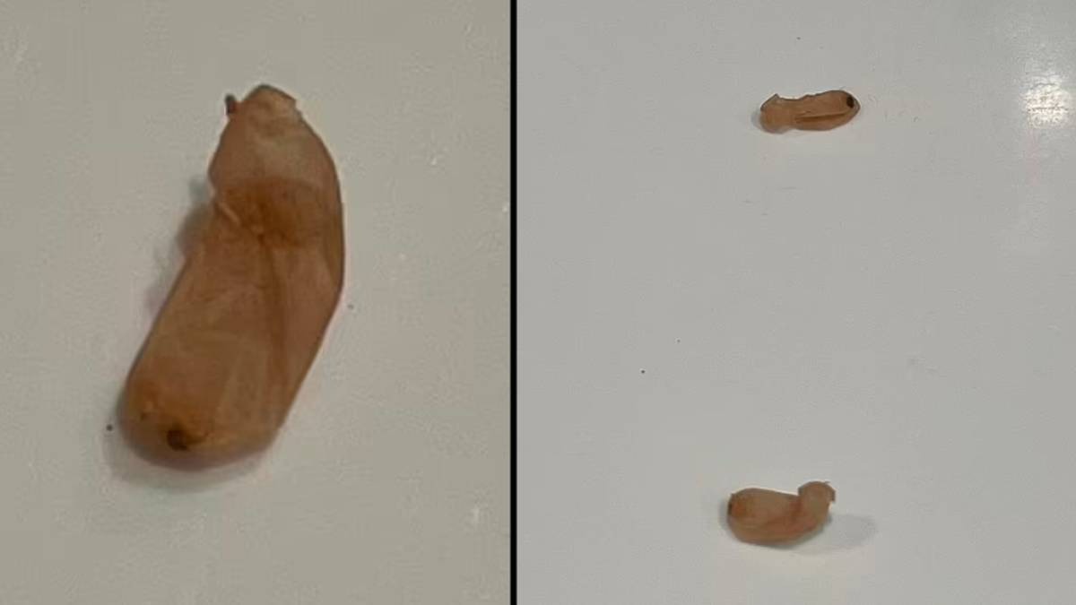 Disturbing version after a woman discovered obscure ‘beans’ in her bathroom
