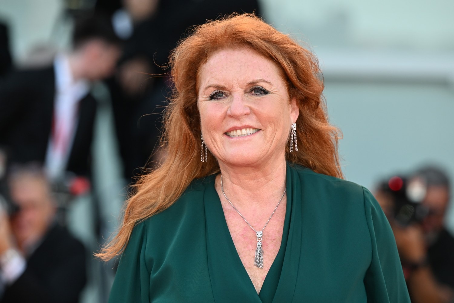 Sarah Ferguson was shocked to receive a diagnosis of malignant melanoma, but she remains in good spirits