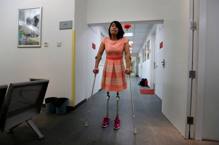 Qian Hongyan, également connue sous le nom de “fille au ballon de basket”, est devenue millionnaire dix ans après avoir perdu ses jambes à la suite d’un grave accident.