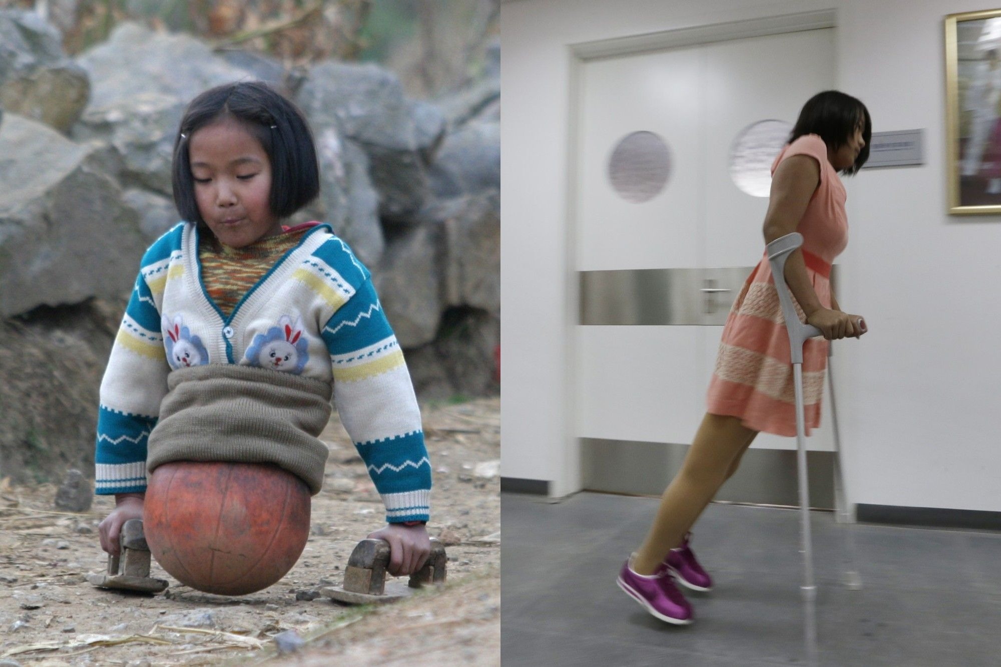 Qian Hongyan, également connue sous le nom de “fille au ballon de basket”, est devenue millionnaire dix ans après avoir perdu ses jambes à la suite d’un grave accident.