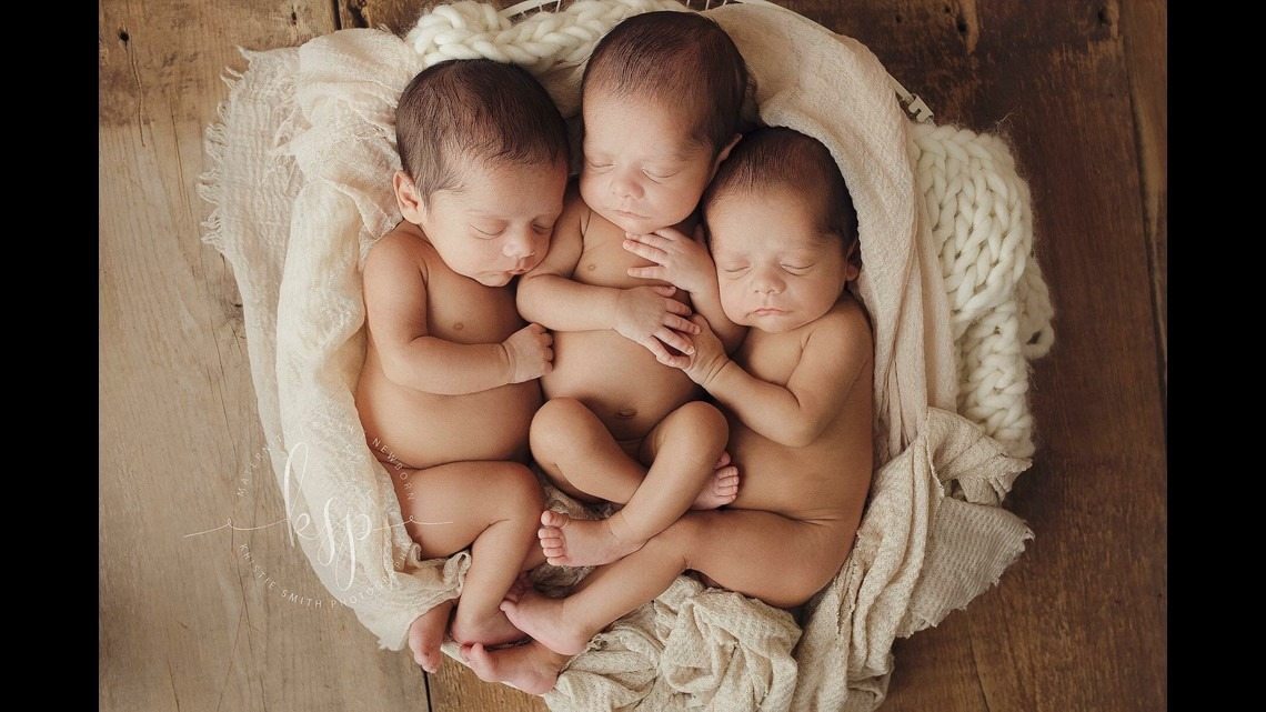 Mother Gives Birth to Triplets, But The Doctor Is Stunned When He Sees One of The Girls Open Her Eyes