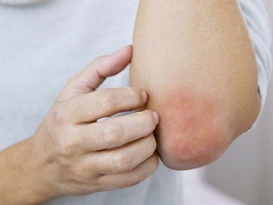 What diseases may be indicated by the presence of rough elbows?