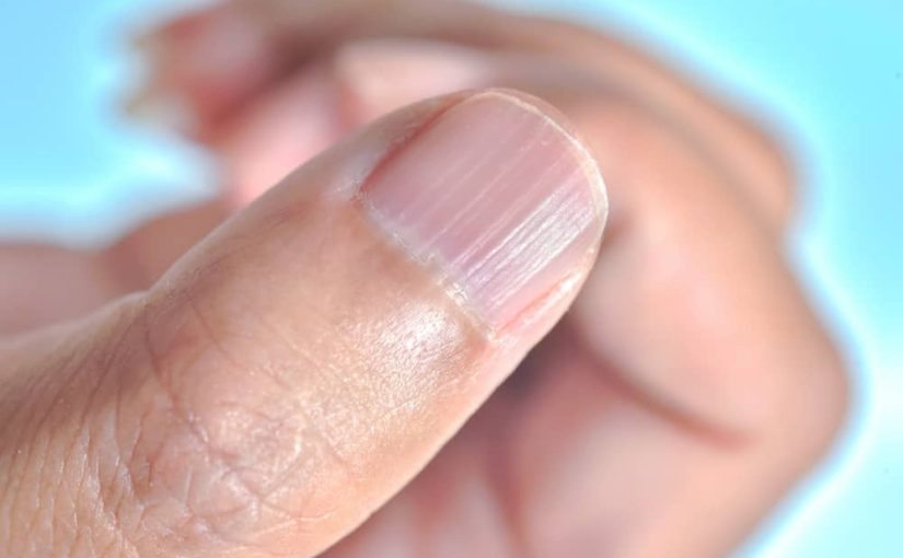 Why nails become ribbed: a vital sign ➤ Buzzday.info