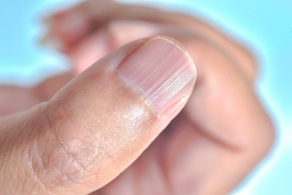 Why nails become ribbed: a vital sign ➤ Buzzday.info