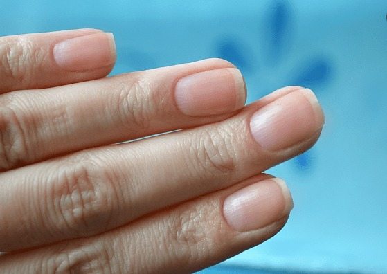 Nail Lunes: How They Relate to Health