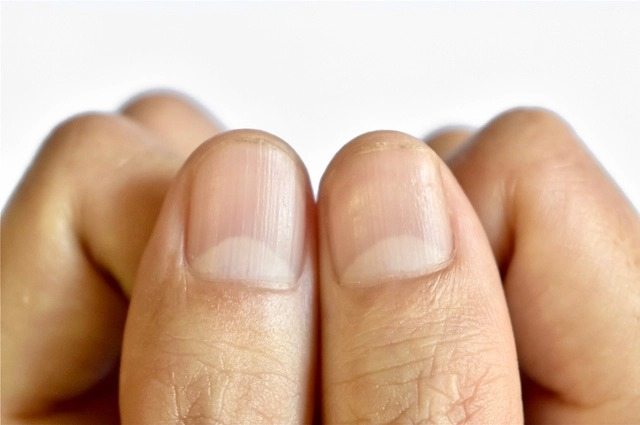 Lunules des ongles : leur lien avec la santé ➤ Buzzday.info