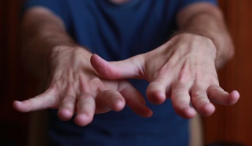 Lekarze nazywają to „linią śmierci”. Gdy pojawi się na paznokciu, nie można już nic zrobić ➤ Buzzday.info