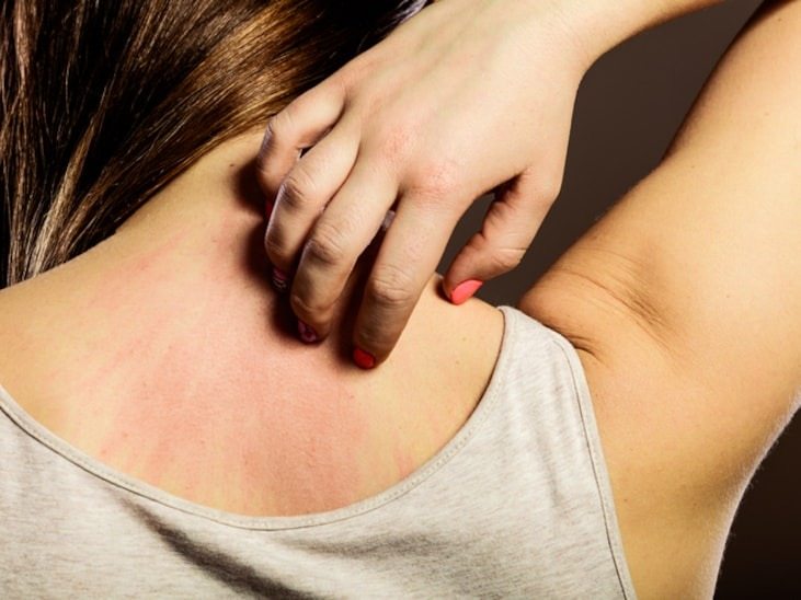 Doctors warn: if you have these tiny red dots on your arm or hand, do not ignore the warning signs