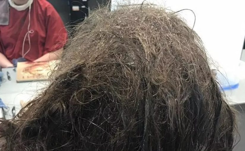 Hairdressers refuse to shave depressed teen’s matted hair ➤ Buzzday.info