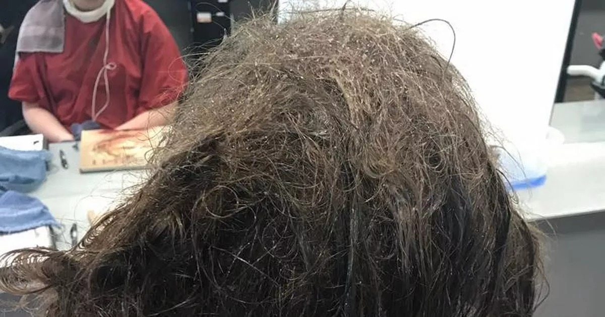 Hairdressers refuse to shave depressed teen’s matted hair ➤ Buzzday.info