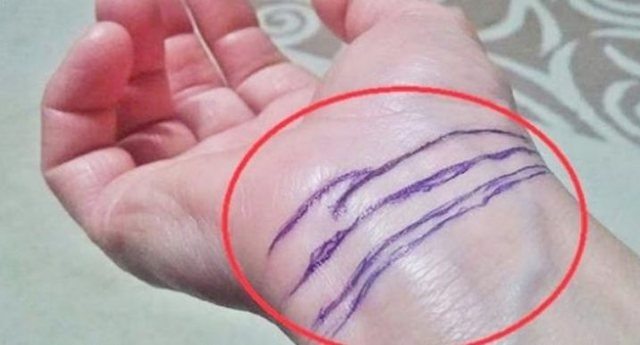 Do you have these stripes on your wrist? Find out what each of them means