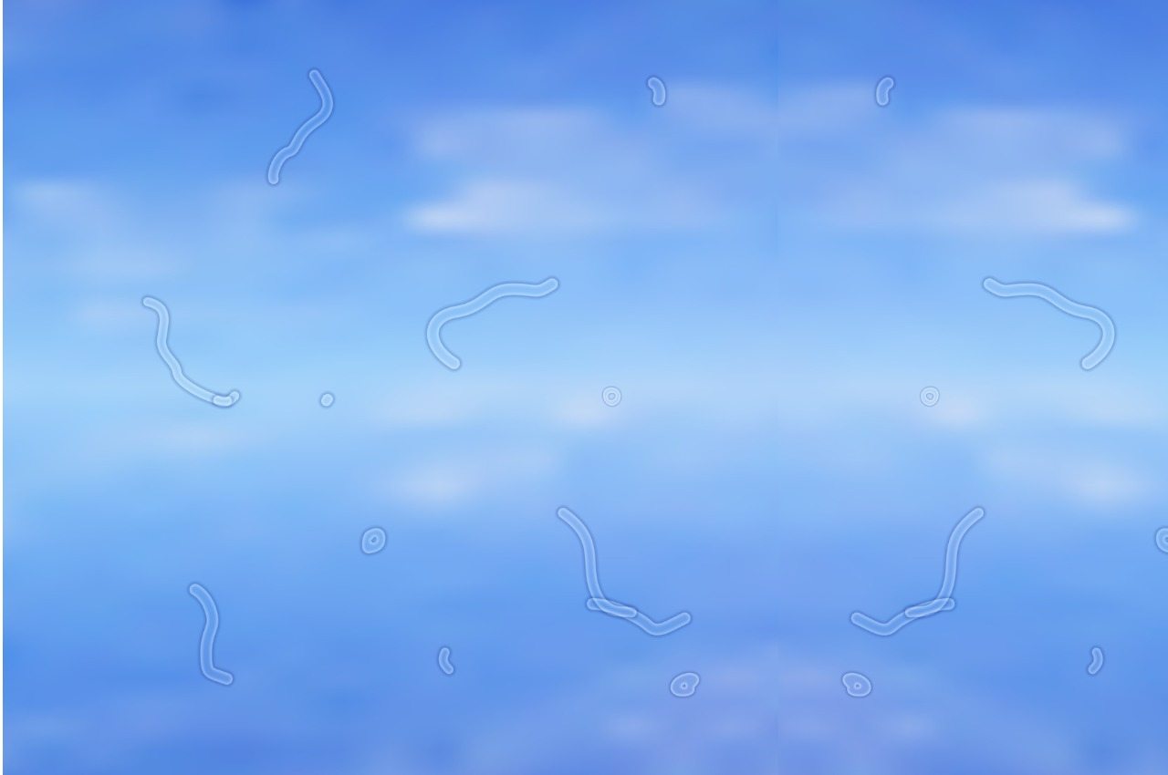 What Are Eye Floaters? Here is some advice on what to do if you start seeing an eye doctor