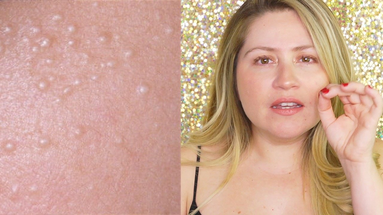 Meaning behind why people sometimes get small white spots across their bodies.They can sometimes have serious problems