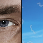 What Are Eye Floaters? Here is some advice on what to do if you start seeing an eye doctor ➤ Buzzday.info