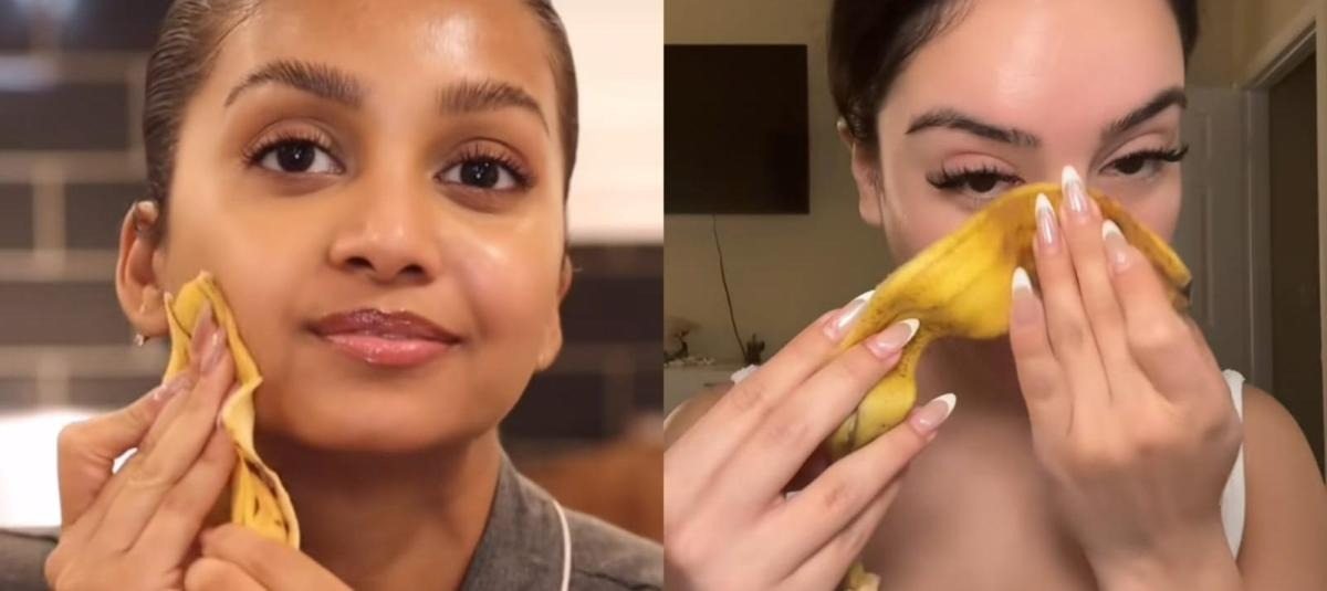 Una donna si mette una buccia di banana sul braccio. Non crederai a quello che è successo dopo!