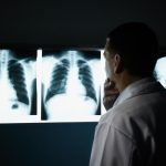 Un uomo va a fare un controllo di routine. Il medico guarda la radiografia e dice: “Mi dispiace” ➤ Buzzday.info