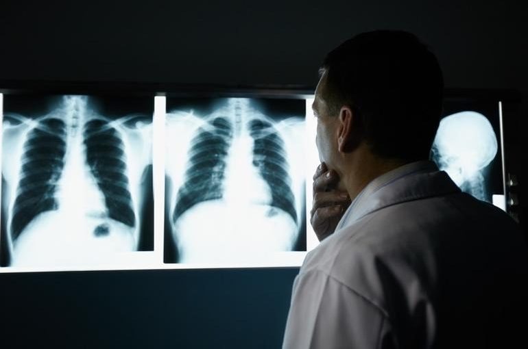 Un uomo va a fare un controllo di routine. Il medico guarda la radiografia e dice: “Mi dispiace” ➤ Buzzday.info