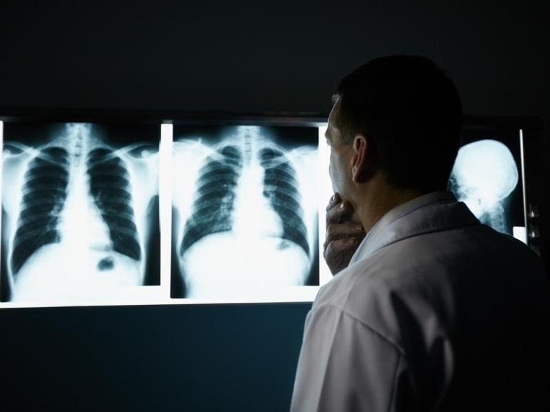 Un uomo va a fare un controllo di routine. Il medico guarda la radiografia e dice: “Mi dispiace” ➤ Buzzday.info
