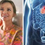 Ten objaw jest powszechny u pacjentów z rakiem trzustki. Przybylska również go miała ➤ Buzzday.info