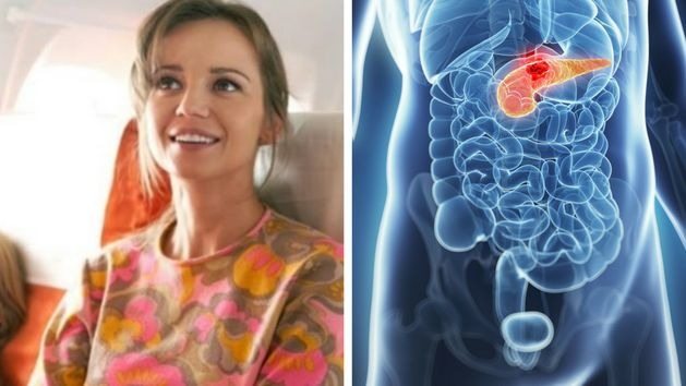 Ten objaw jest powszechny u pacjentów z rakiem trzustki. Przybylska również go miała ➤ Buzzday.info