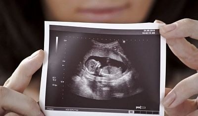 She thought her pregnancy was over. But three weeks later, the doctors discovered something unimaginable