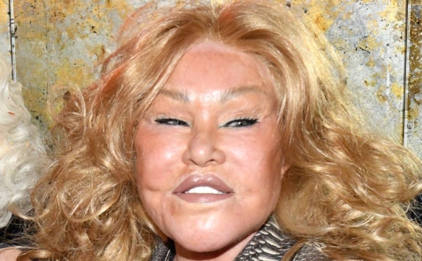 Celebrities Whose Plastic Surgeries Caused a Resonance: What the Experts Say ➤ Buzzday.info