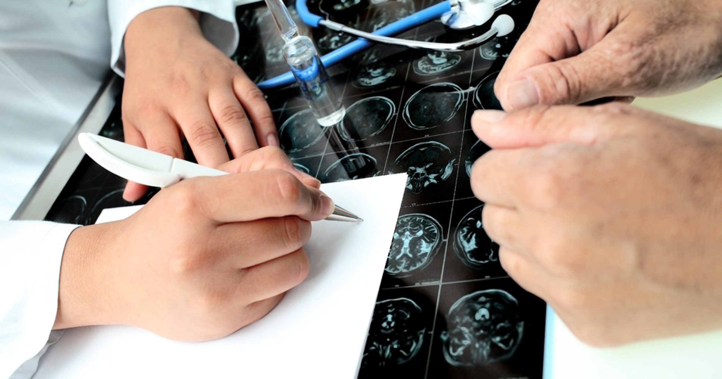 Tak mogą wyglądać wczesne stadia choroby Alzheimera. Ujawnia neurolog. To pierwszy objaw choroby