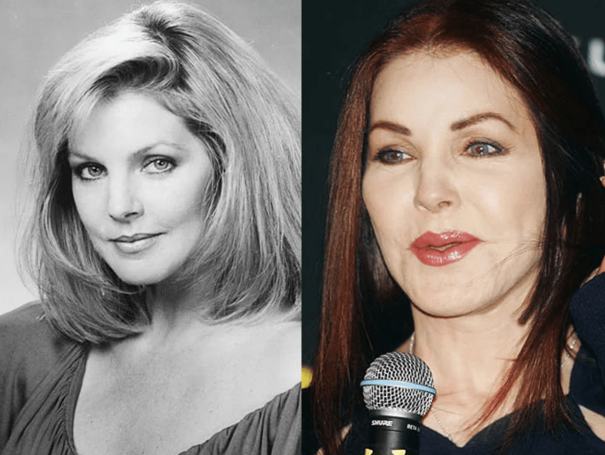 Celebrità i cui interventi di chirurgia plastica hanno suscitato scalpore: cosa dicono gli esperti