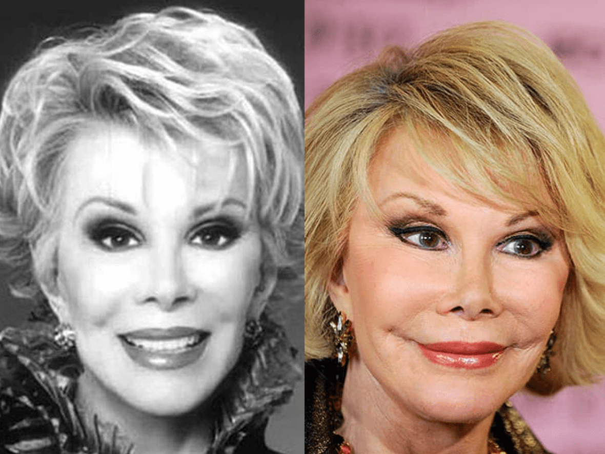 Gwiazdy, których operacje plastyczne wywołały poruszenie: Co mówią eksperci