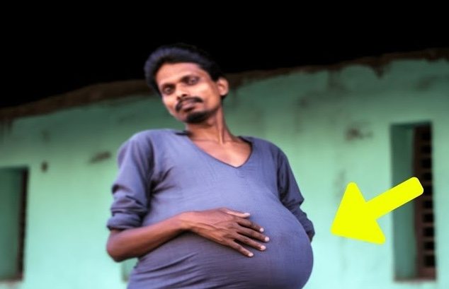 Rutynowe badanie lekarskie przerodziło się w wydarzenie, które na zawsze odmieniło życie Rohana Agarwala ➤ Buzzday.info