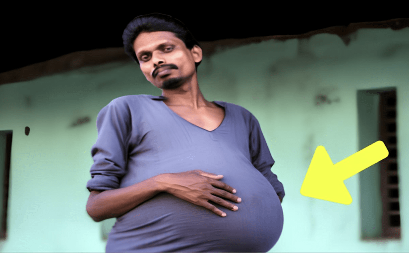 Una visita medica di routine si trasformò in un evento che avrebbe cambiato per sempre la vita di Rohan Agarwal ➤ Buzzday.info