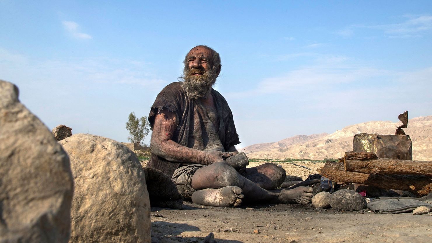 Ugh! This man hasn’t washed in 65 years!