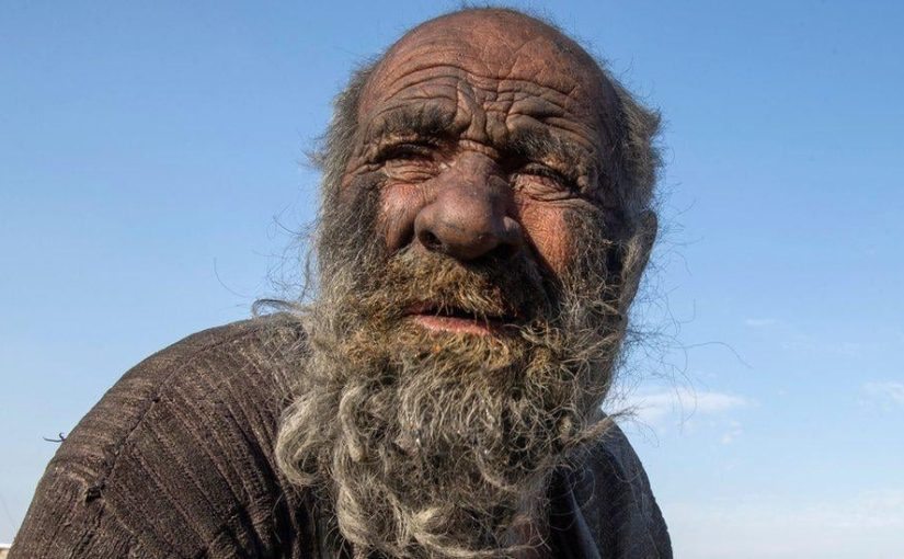 Ugh! This man hasn’t washed in 65 years! ➤ Buzzday.info