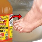 What a Vinegar Foot Bath Can Do ➤ Buzzday.info