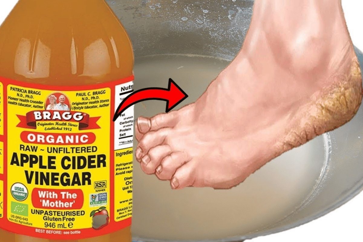 What a Vinegar Foot Bath Can Do ➤ Buzzday.info