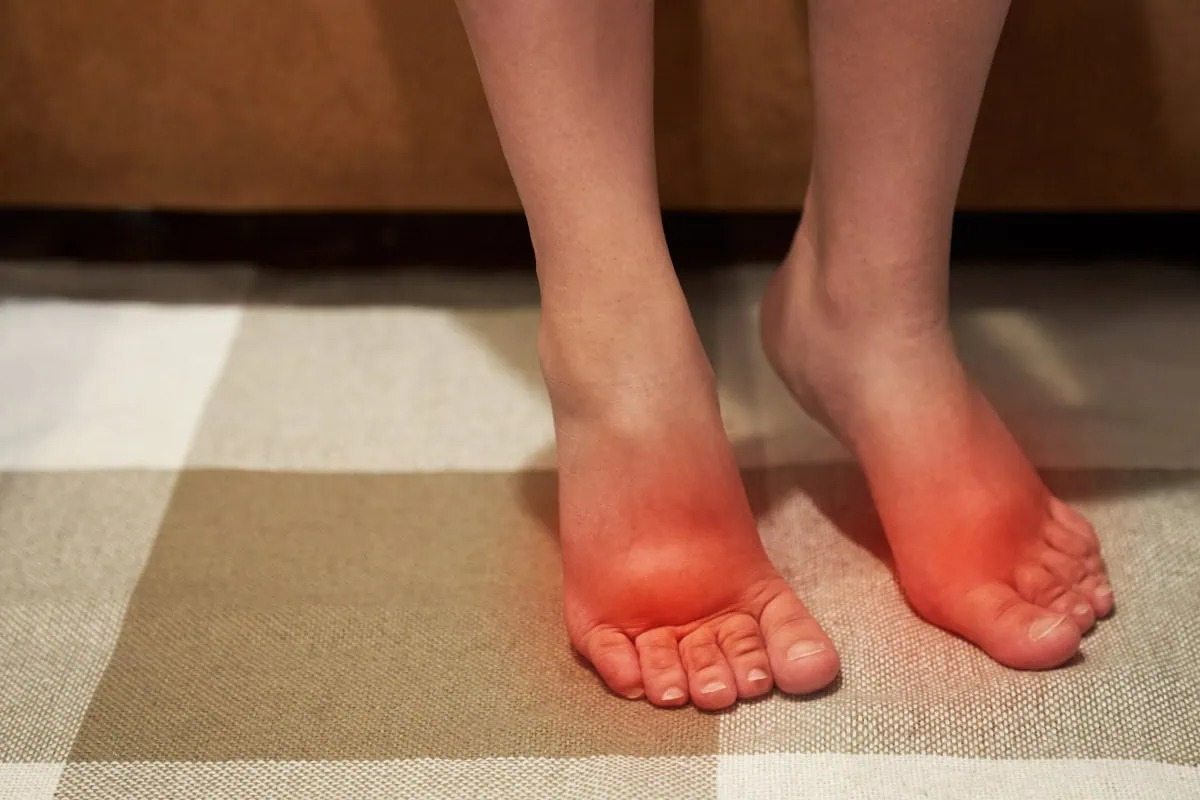 Here’s What’s Causing Your Feet to Swell (And What to Do)