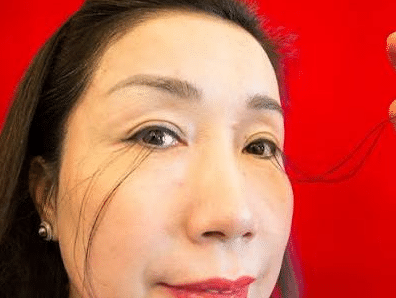 Her eyelashes grew to 20.5 cm—doctors found no explanation